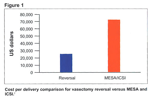 Vasectomy Reversal Procedure  Images of a Reverse Vasectomy